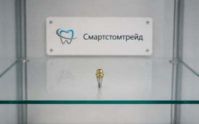 Когда нужен мультиюнит (Multi Unit) при имплантации зубов